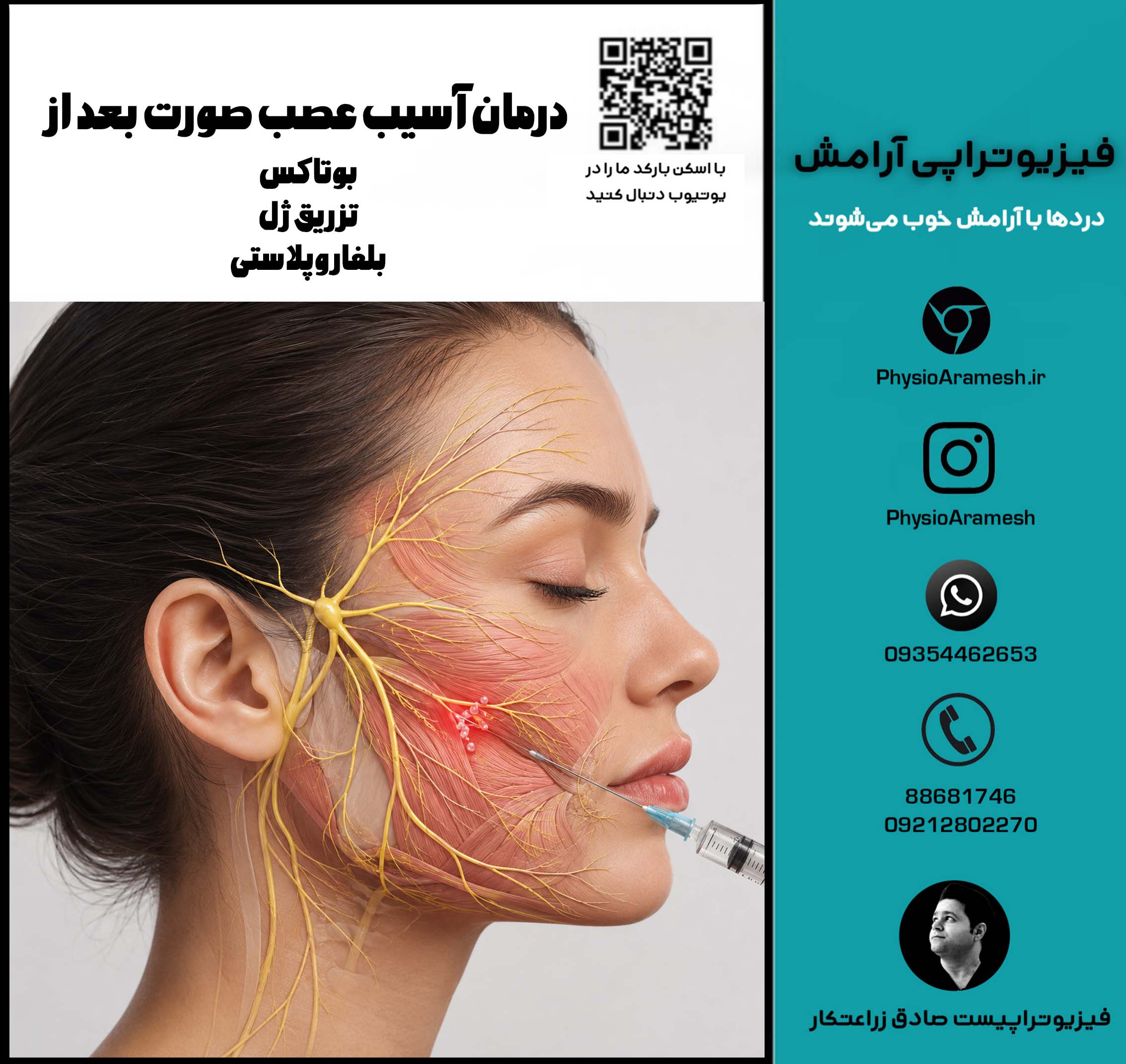 فیزیوتراپی آسیب عصب صورت بعد از بوتاکس تزریق ژل و جراحی لیفت